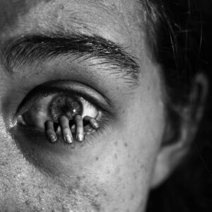 Dalya Prezant - Emerging Extremities